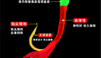 Fish Skin Bait Rig, Red or Green, 6 or 8 Hooks – product photo